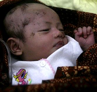 Two-month old baby survivor - Photo: Christian Science Monitor